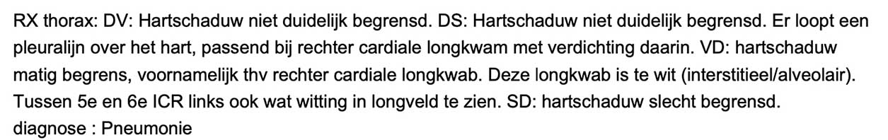 Uit de r�ntgenfoto beoordeling komt een pneumonie